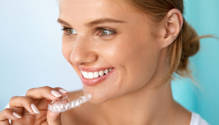 Clear Aligners vs. Traditional Braces