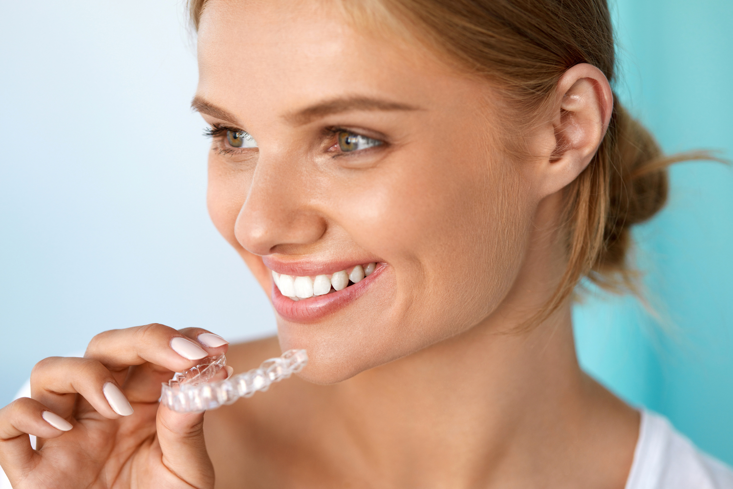 Clear Aligners vs. Traditional Braces