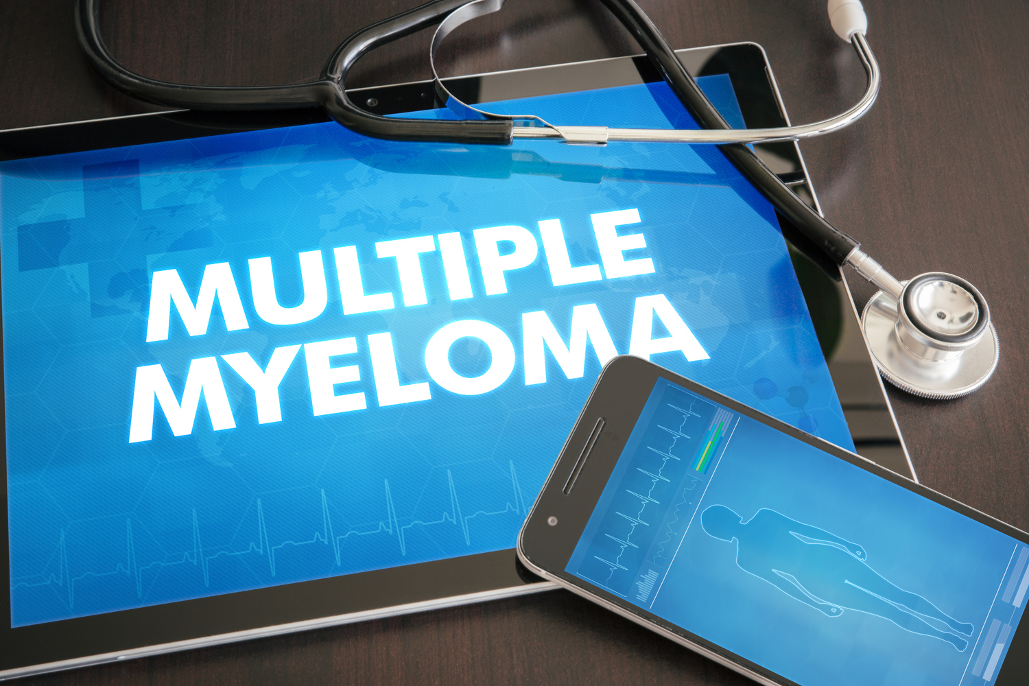 An overview on multiple myeloma