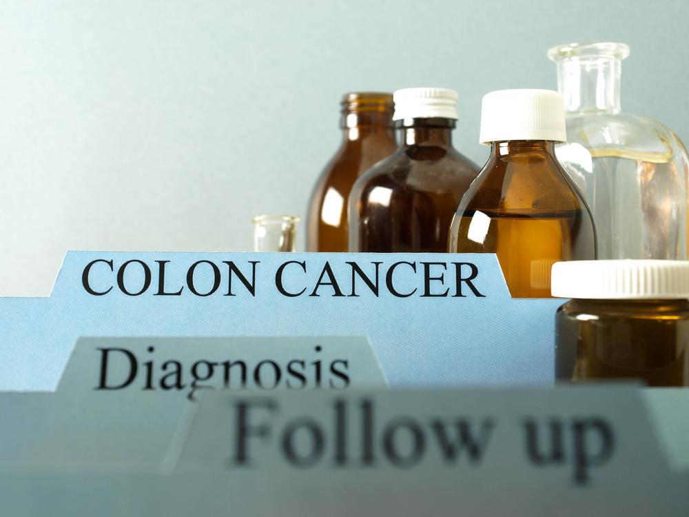 Essential things to know about colon cancer